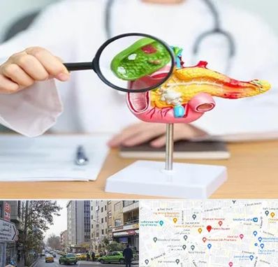 جراح سرطان پانکراس در فاطمی