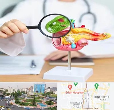 جراح سرطان پانکراس در ونک 