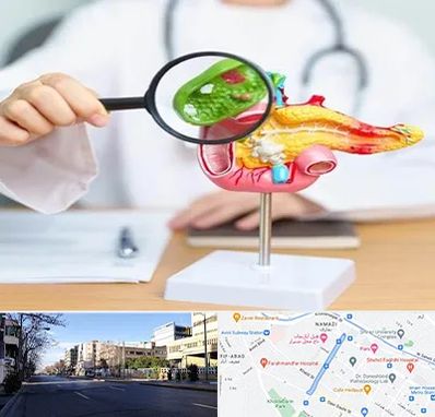 جراح سرطان پانکراس در خیابان ملاصدرا شیراز 