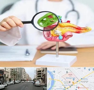 جراح سرطان پانکراس در زیتون کارمندی اهواز 