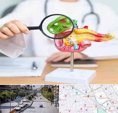 جراح سرطان پانکراس در خیابان زند شیراز 