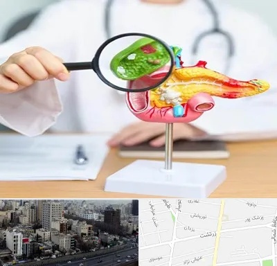 جراح سرطان پانکراس در زرتشت