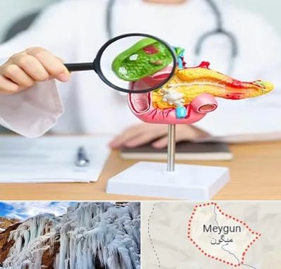 جراح سرطان پانکراس در میگون