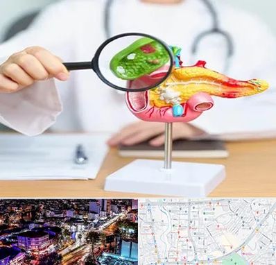 جراح سرطان پانکراس در منظریه رشت 