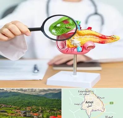 جراح سرطان پانکراس در آمل