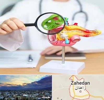 جراح سرطان پانکراس در زاهدان