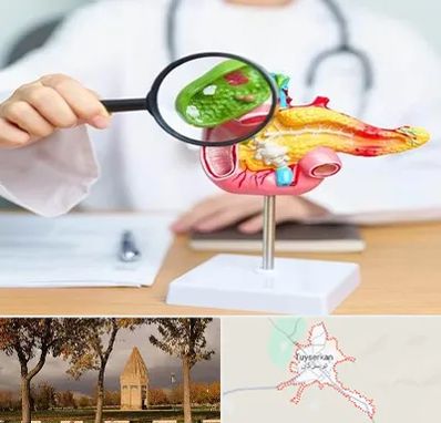 جراح سرطان پانکراس در تویسرکان