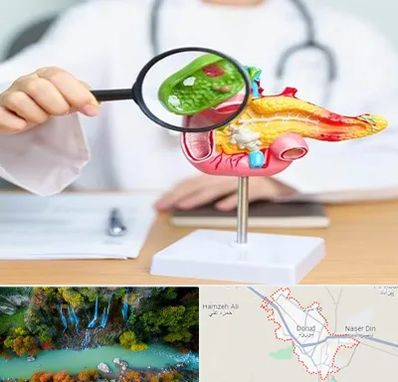 جراح سرطان پانکراس در دورود