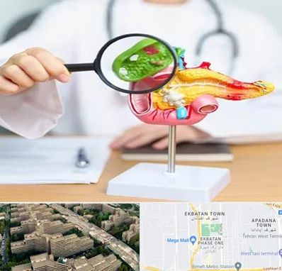 جراح سرطان پانکراس در اکباتان 