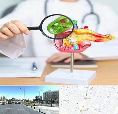 جراح سرطان پانکراس در بلوار کلاهدوز مشهد 