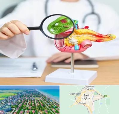 جراح سرطان پانکراس در ساری