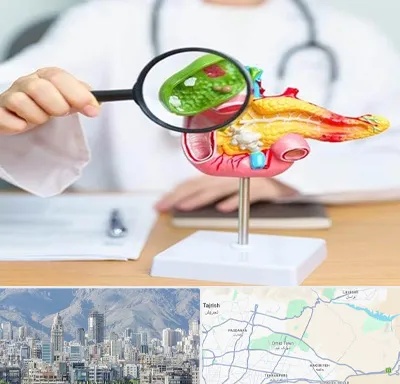 جراح سرطان پانکراس در شمال شرق تهران