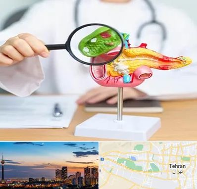 جراح سرطان پانکراس در غرب تهران 