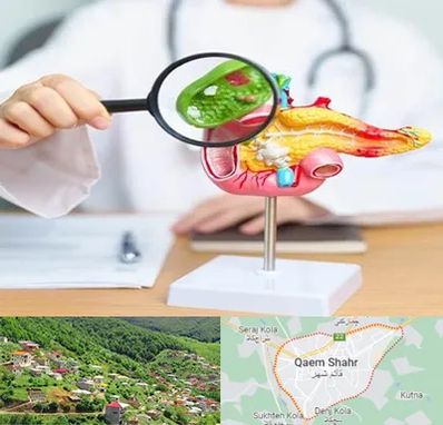 جراح سرطان پانکراس در قائم شهر
