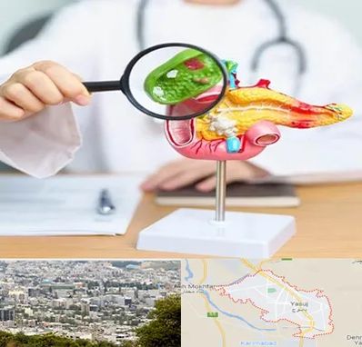 جراح سرطان پانکراس در یاسوج