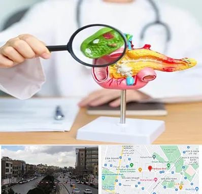 جراح سرطان پانکراس در بلوار فردوسی مشهد 