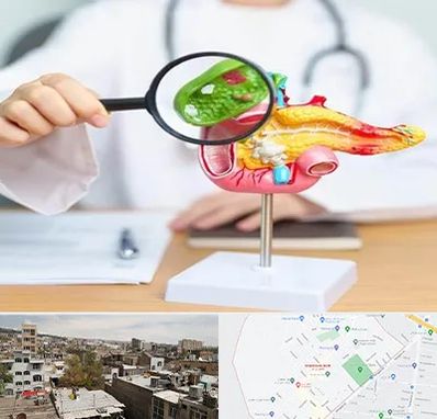 جراح سرطان پانکراس در شمیران نو