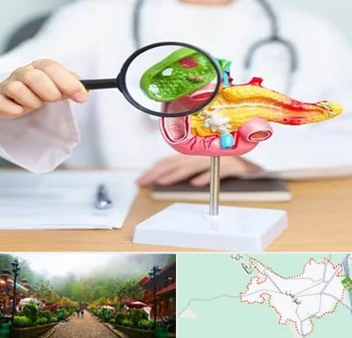 جراح سرطان پانکراس در فومن
