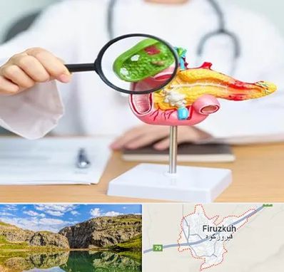 جراح سرطان پانکراس در فیروزکوه
