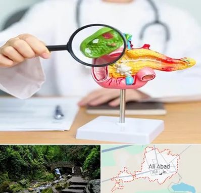جراح سرطان پانکراس در علی‌ آباد کتول