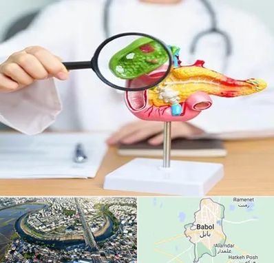 جراح سرطان پانکراس در بابل