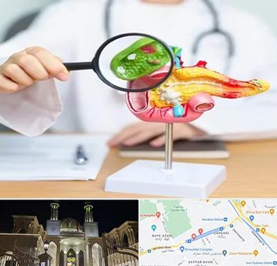 جراح سرطان پانکراس در زرگری شیراز 