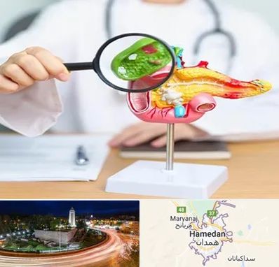 جراح سرطان پانکراس در همدان