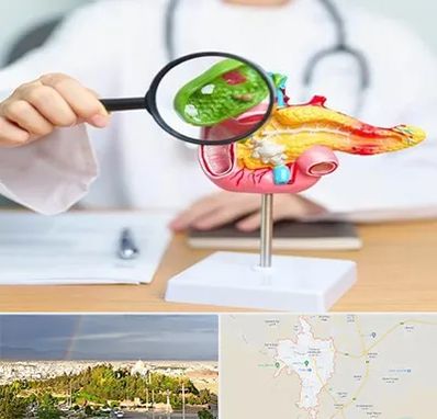 جراح سرطان پانکراس در تربت حیدریه