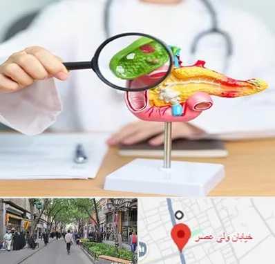 جراح سرطان پانکراس در ولیعصر شهریار