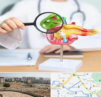 جراح سرطان پانکراس در کوی وحدت شیراز 