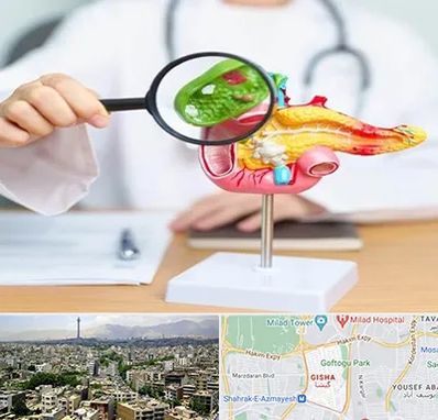جراح سرطان پانکراس در گیشا