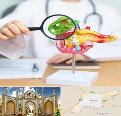 جراح سرطان پانکراس در سمنان