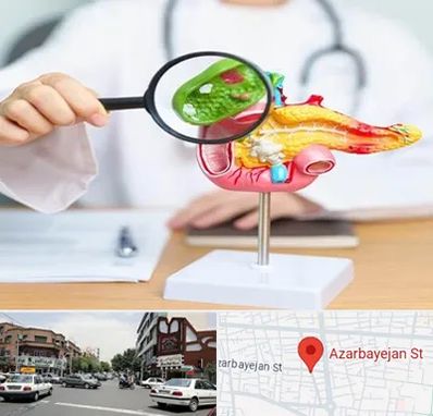 جراح سرطان پانکراس در خیابان آذربایجان