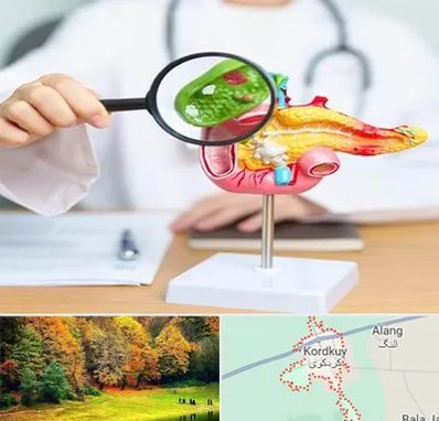 جراح سرطان پانکراس در کردکوی