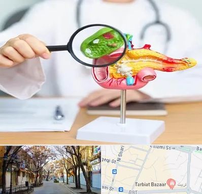 جراح سرطان پانکراس در تربیت تبریز