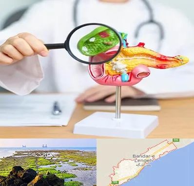 جراح سرطان پانکراس در بندرلنگه