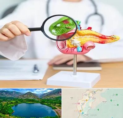 جراح سرطان پانکراس در رودبار