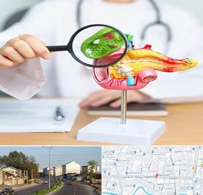 جراح سرطان پانکراس در ضیابری رشت 