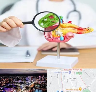 جراح سرطان پانکراس در گلسار رشت 