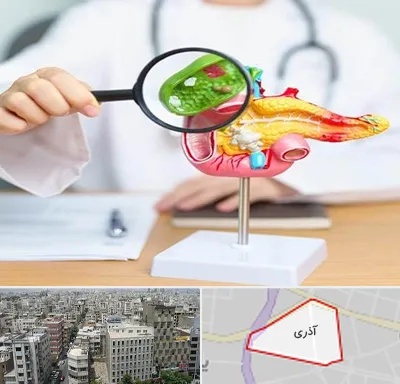 جراح سرطان پانکراس در آذری