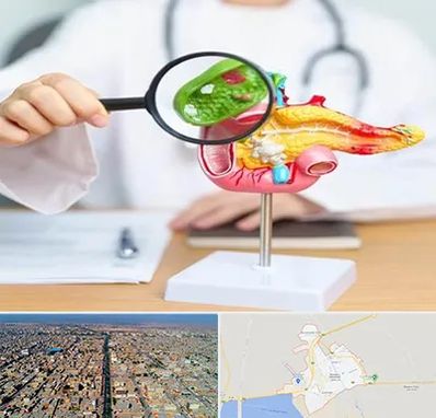 جراح سرطان پانکراس در بندر ماهشهر