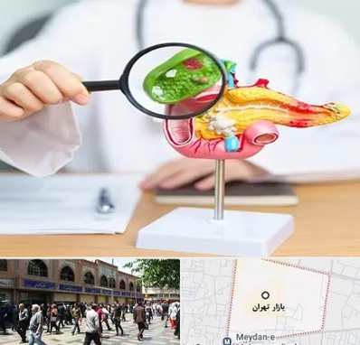جراح سرطان پانکراس در بازار تهران