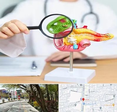 جراح سرطان پانکراس در خیابان توحید اصفهان 