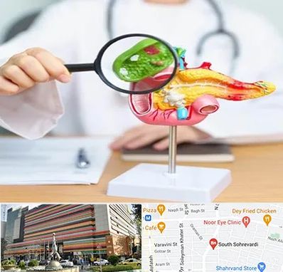 جراح سرطان پانکراس در سهروردی 