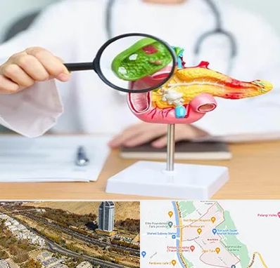 جراح سرطان پانکراس در خیابان نیایش شیراز 