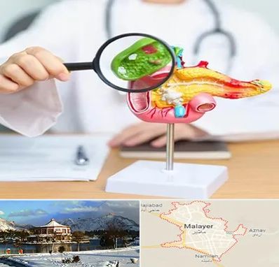 جراح سرطان پانکراس در ملایر