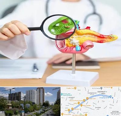 جراح سرطان پانکراس در اندرزگو 