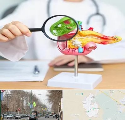 جراح سرطان پانکراس در نظرآباد کرج 