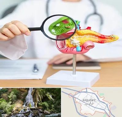 جراح سرطان پانکراس در الیگودرز