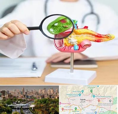 جراح سرطان پانکراس در منطقه 1 تهران 